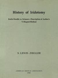 History of Iridotomy
Knife-Needle vs. Scissors—Description of Author's V-Shaped Method